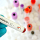 Illustration for article titled Ugandan Creates Device to Detect Malaria